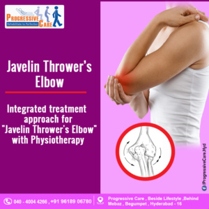 Javelin Throwers Elbow (or) Golf Elbow